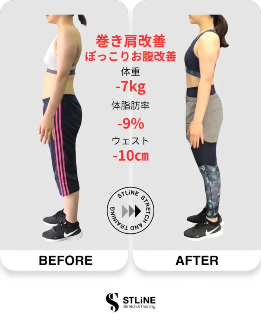 お客様のビフォーアフター(巻き肩改善・ぽっこりお腹改善/体重 -7kg / 体脂肪率 -9% / ウエスト -10cm)
